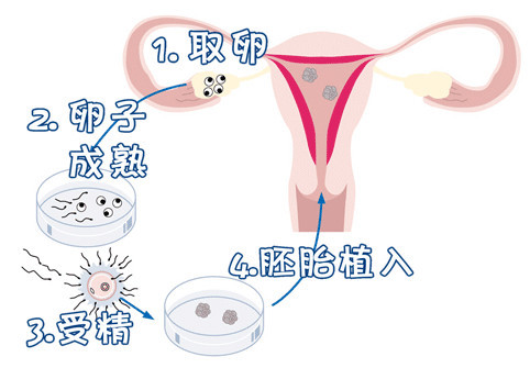 妇科专家